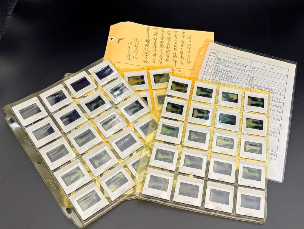 1996年肺結核投影片 (胸腔外科捐贈)